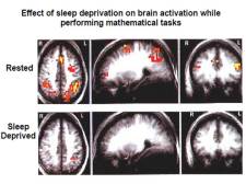 Professor Foster --effect of sleep deprivation on brain tasks
